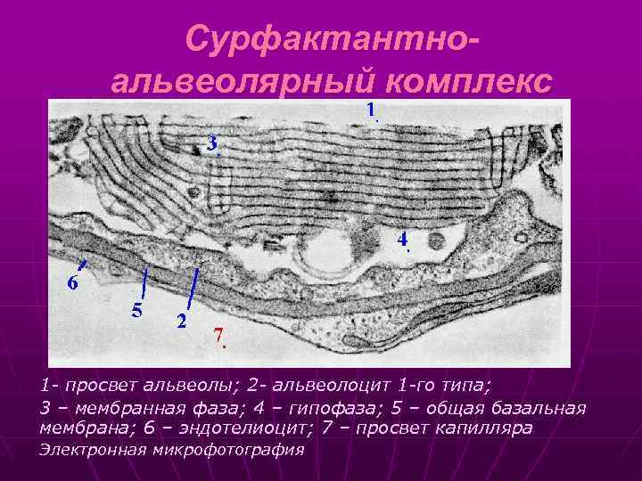 Сурфактантноальвеолярный комплекс 1 - просвет альвеолы; 2 - альвеолоцит 1 -го типа; 3 –