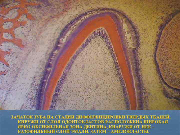 ЗАЧАТОК ЗУБА НА СТАДИИ ДИФФЕРЕНЦИРОВКИ ТВЕРДЫХ ТКАНЕЙ. КНРУЖИ ОТ СЛОЯ ОДОНТОБЛАСТОВ РАСПОЛОЖЕНА ШИРОКАЯ ЯРКО