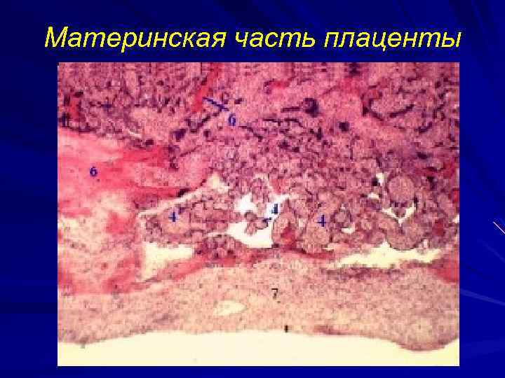 Материнская часть плаценты 