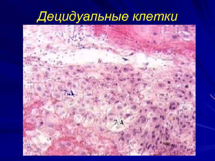 Децидуальные клетки 