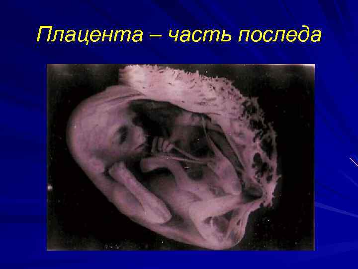 Плацента – часть последа 