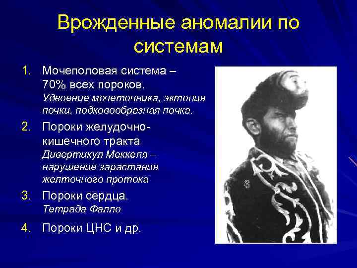 Врожденные аномалии по системам 1. Мочеполовая система – 70% всех пороков. Удвоение мочеточника, эктопия