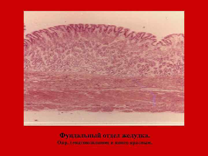 Фундальный отдел желудка. Окр. гематоксилином и конго красным. 