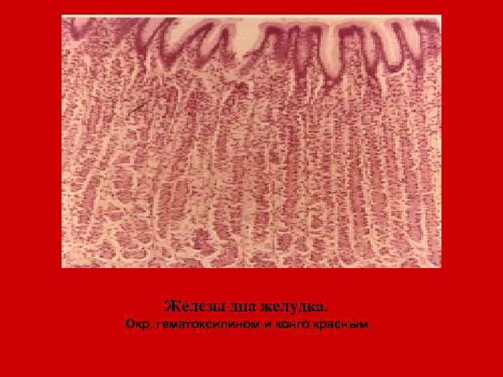 Железы дна желудка. Окр. гематоксилином и конго красным. 