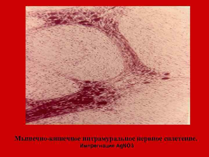 Мышечно-кишечное интрамуральное нервное сплетение. Импрегнация Ag. NO 3 