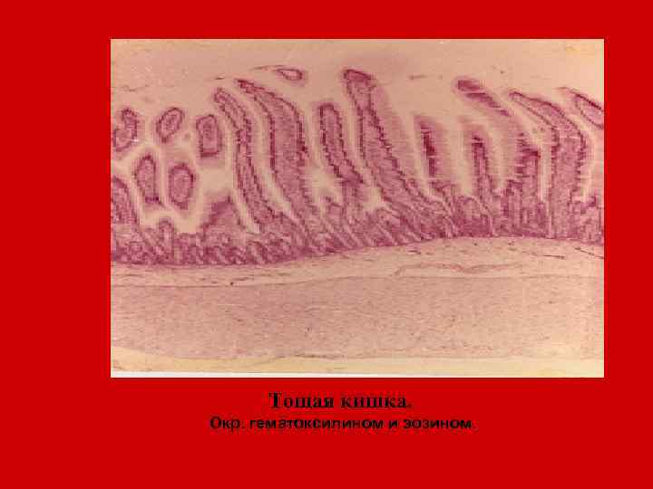 Тощая кишка. Окр. гематоксилином и эозином. 