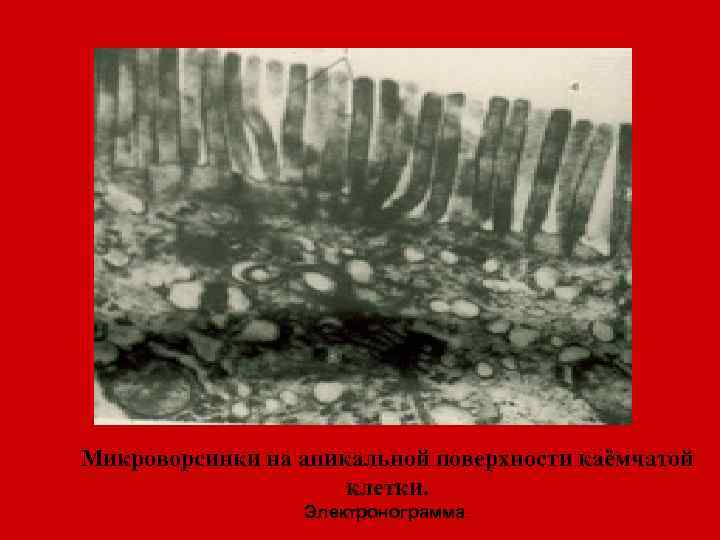Микроворсинки на апикальной поверхности каёмчатой клетки. Электронограмма. 