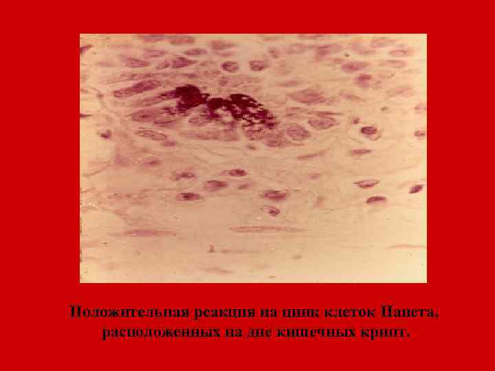 Положительная реакция на цинк клеток Панета, расположенных на дне кишечных крипт. 