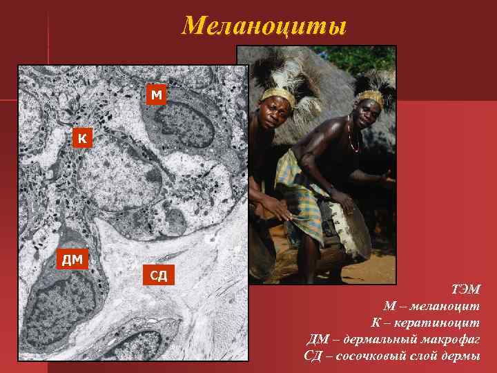Меланоциты М К ДМ СД ТЭМ М – меланоцит К – кератиноцит ДМ –