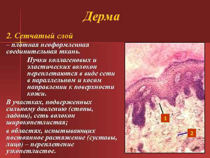 Дерма 2. Сетчатый слой – плотная неоформленная соединительная ткань. Пучки коллагеновых и эластических волокон
