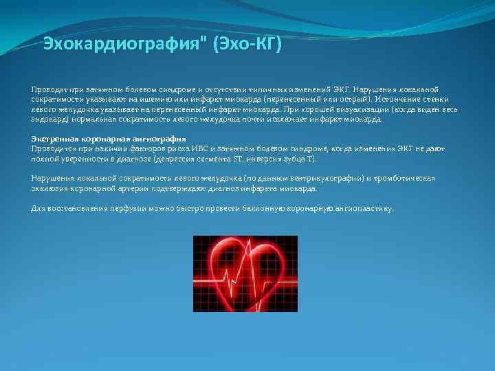  Эхокардиография