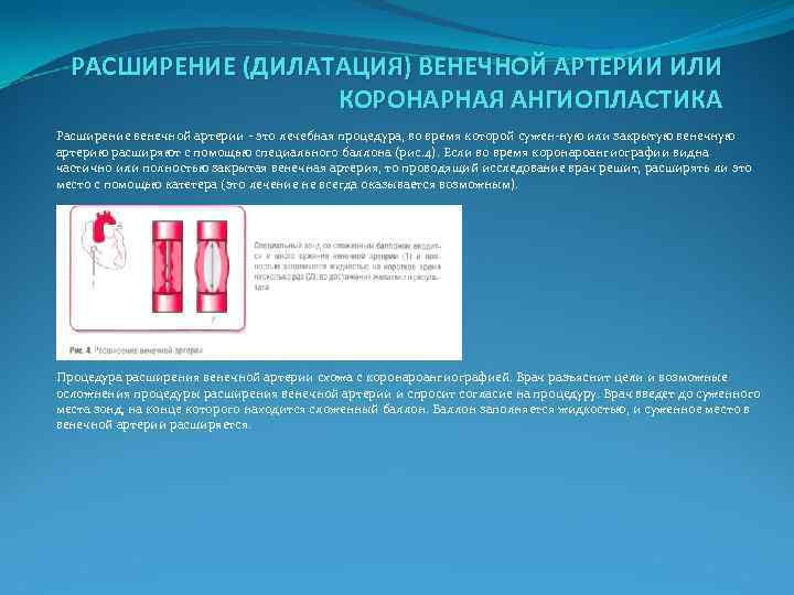  РАСШИРЕНИЕ (ДИЛАТАЦИЯ) ВЕНЕЧНОЙ АРТЕРИИ ИЛИ КОРОНАРНАЯ АНГИОПЛАСТИКА Расширение венечной артерии это лечебная процедура,
