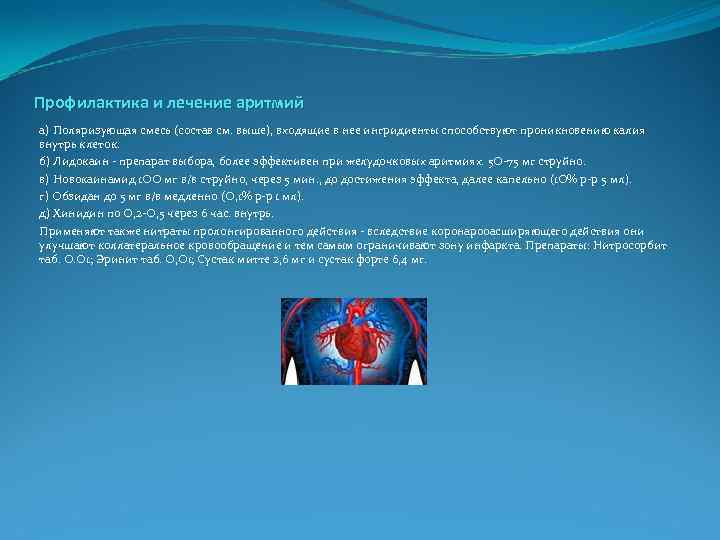 Профилактика и лечение аритмий а) Поляризующая смесь (состав см. выше), входящие в нее