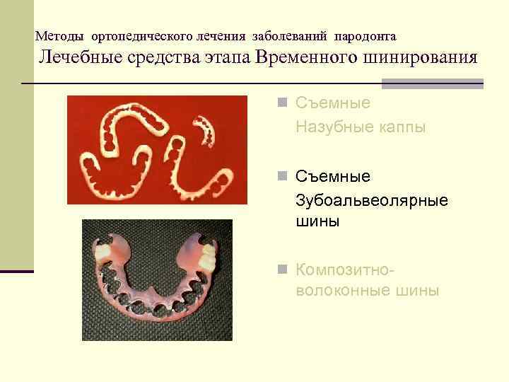 Шинирование зубов при ортопедическом лечении заболеваний пародонта презентация