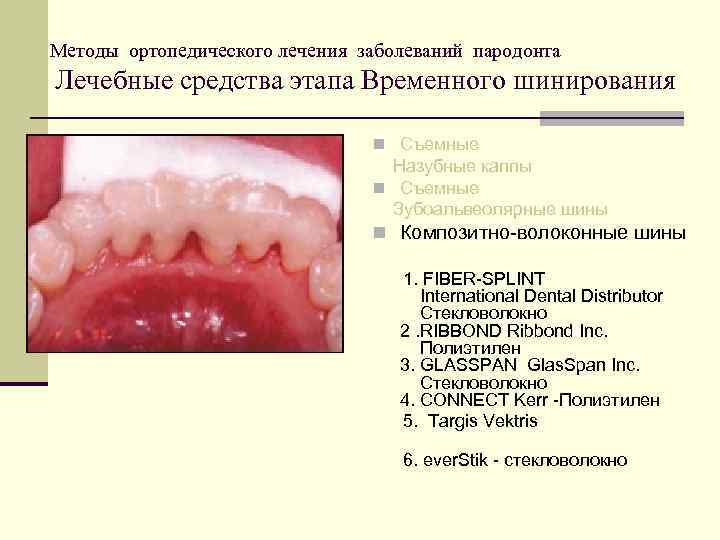Методы ортопедического лечения заболеваний пародонта Лечебные средства этапа Временного шинирования n Съемные Назубные каппы