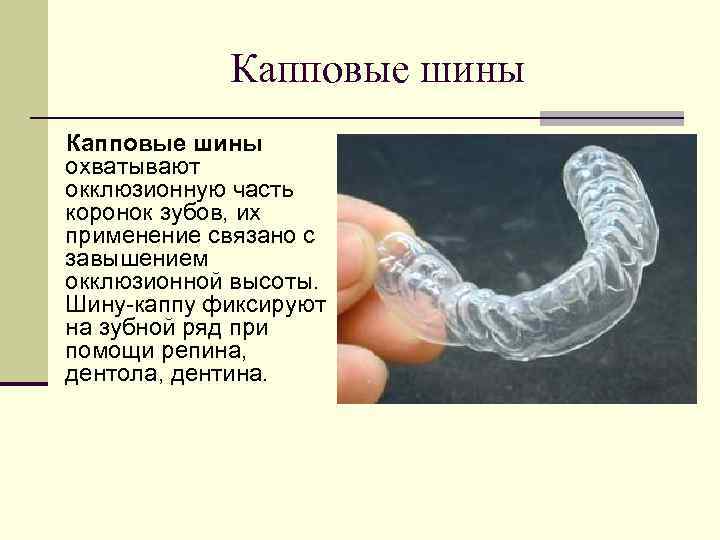 Капповые шины охватывают окклюзионную часть коронок зубов, их применение связано с завышением окклюзионной высоты.