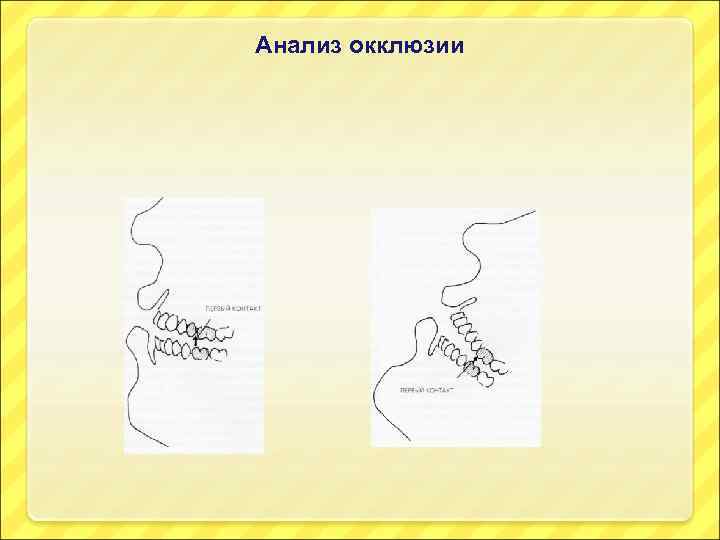 Анализ окклюзии 