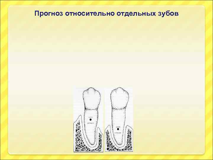 Прогноз относительно отдельных зубов 