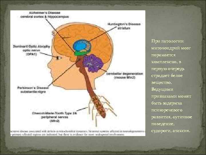 При патологии митохондрий мозг поражается комплексно, в первую очередь страдает белое вещество. Ведущими признаками