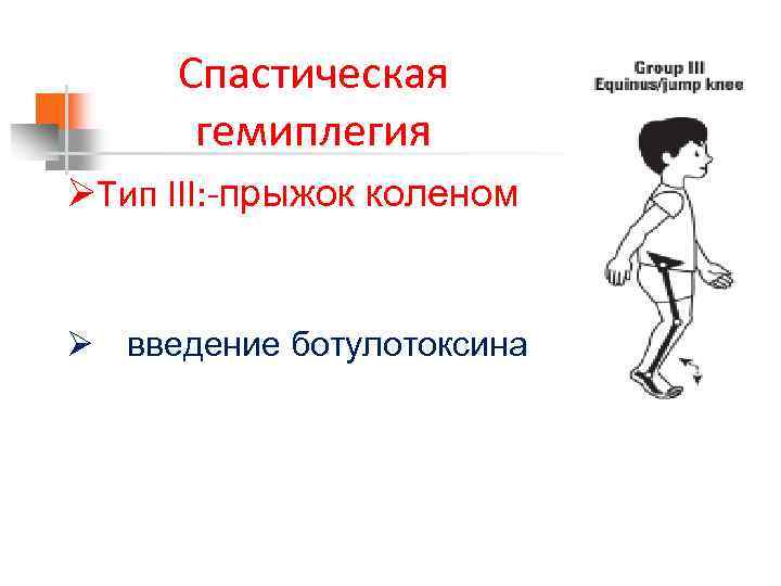 Спастическая гемиплегия ØТип III: -прыжок коленом Ø введение ботулотоксина 