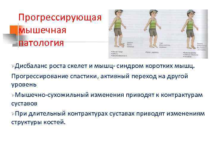 Прогрессирующая мышечная патология Дисбаланс роста скелет и мышц- синдром коротких мышц. Прогрессирование спастики, активный