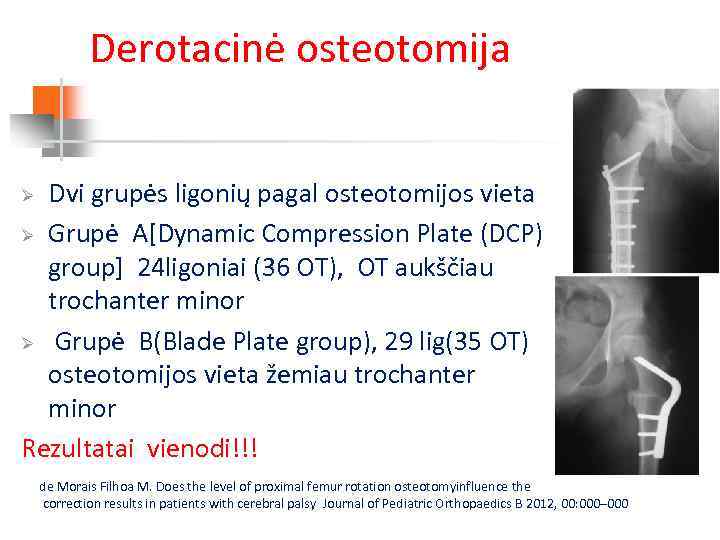 Derotacinė osteotomija Dvi grupės ligonių pagal osteotomijos vieta Ø Grupė A[Dynamic Compression Plate (DCP)