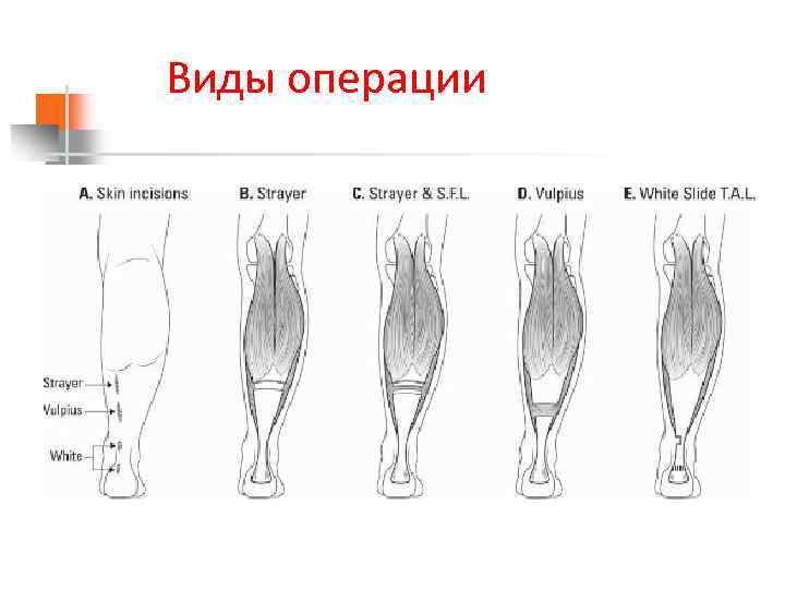 Виды операции 