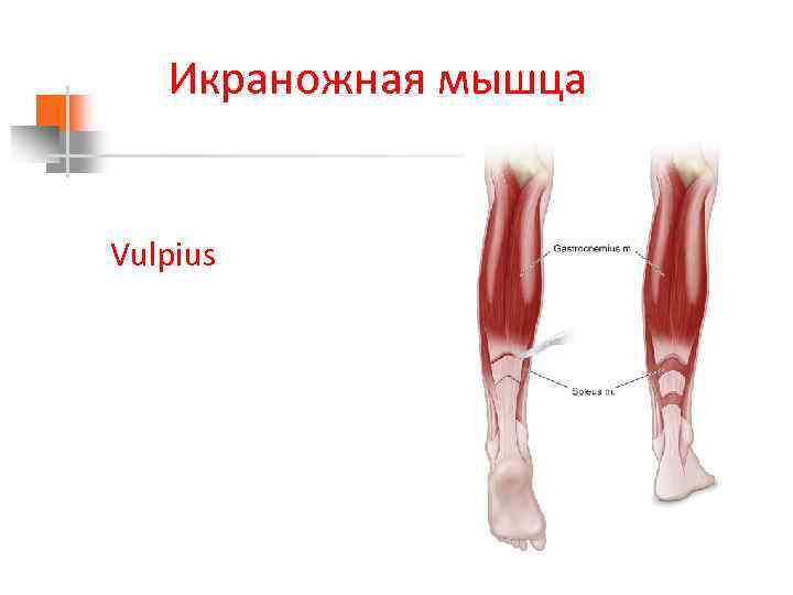 Икраножная мышца Vulpius 
