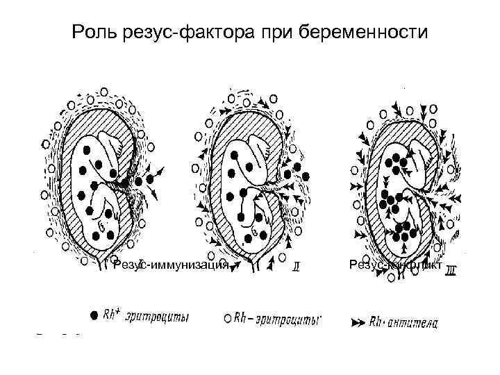 Роль резус-фактора при беременности Резус-иммунизация Резус-конфликт 