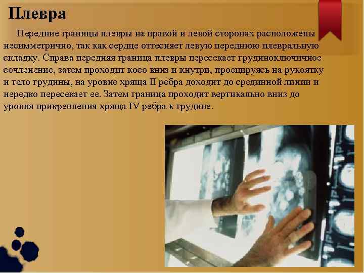 Плевра Передние границы плевры на правой и левой сторонах расположены несимметрично, так как сердце