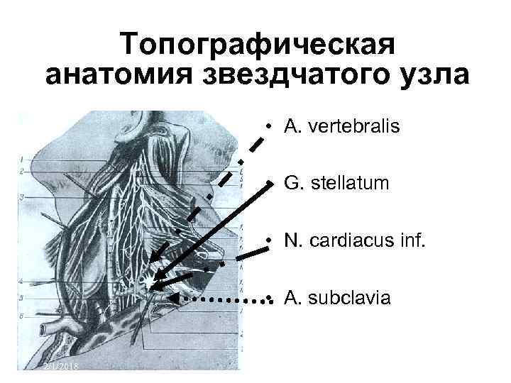 Топографическая анатомия звездчатого узла • A. vertebralis • G. stellatum • N. cardiacus inf.