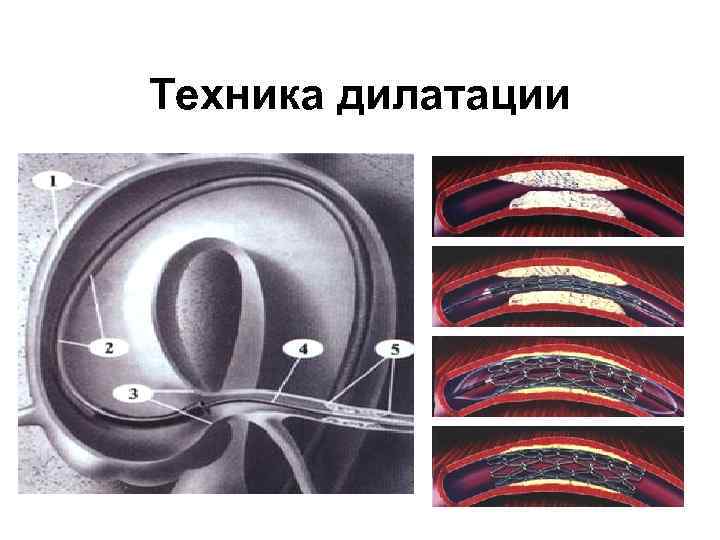Техника дилатации 2/1/2018 