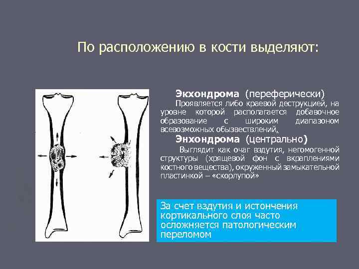 Кт картина краевой деструкции смежных костей наиболее характерна для