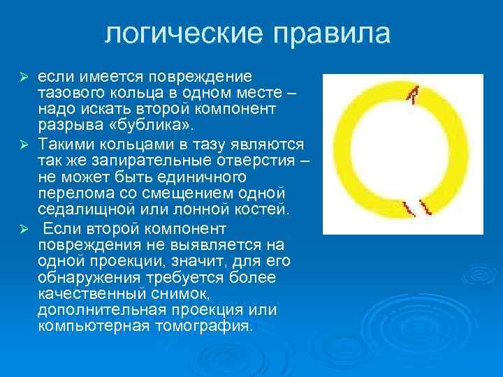 логические правила если имеется повреждение тазового кольца в одном месте – надо искать второй