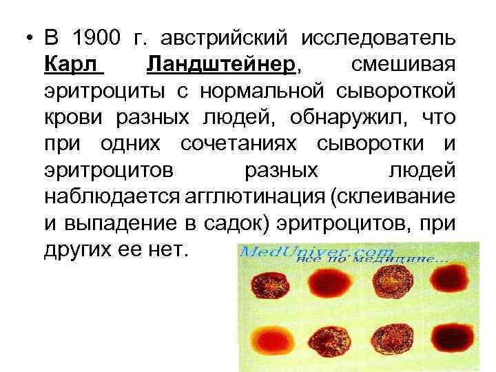  • В 1900 г. австрийский исследователь Карл Ландштейнер, смешивая эритроциты с нормальной сывороткой