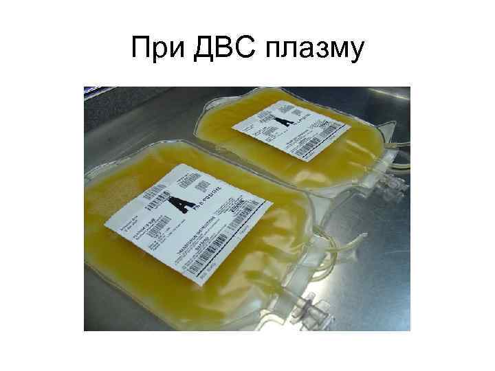 При ДВС плазму 