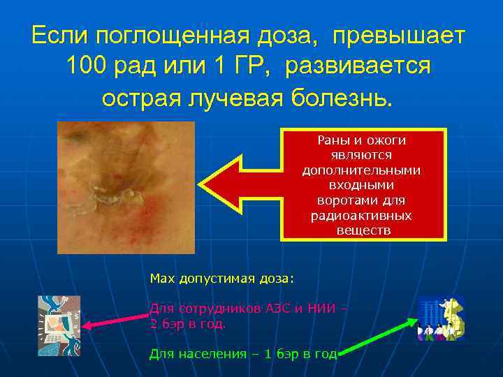 Если поглощенная доза, превышает 100 рад или 1 ГР, развивается острая лучевая болезнь. Раны