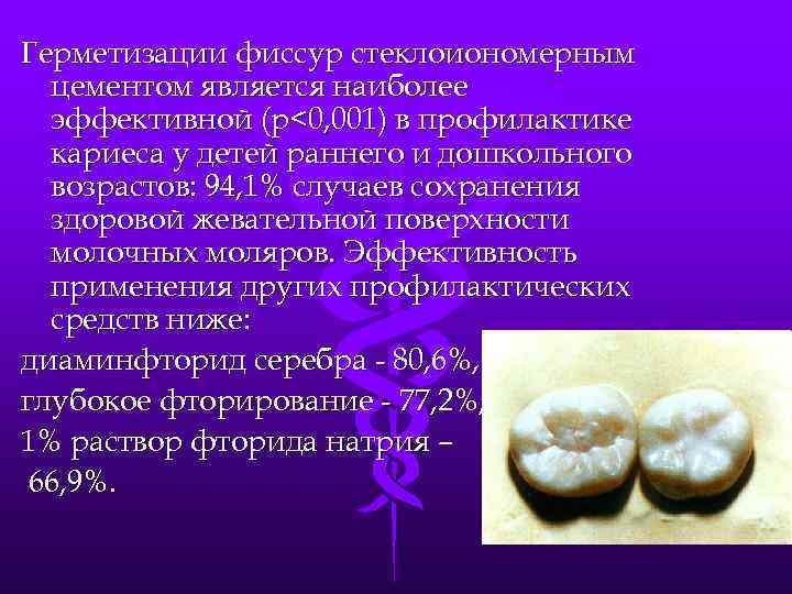 Герметизации фиссур стеклоиономерным цементом является наиболее эффективной (р<0, 001) в профилактике кариеса у детей