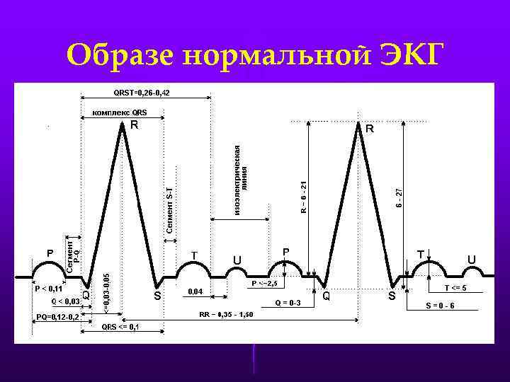 Образе нормальной ЭКГ 