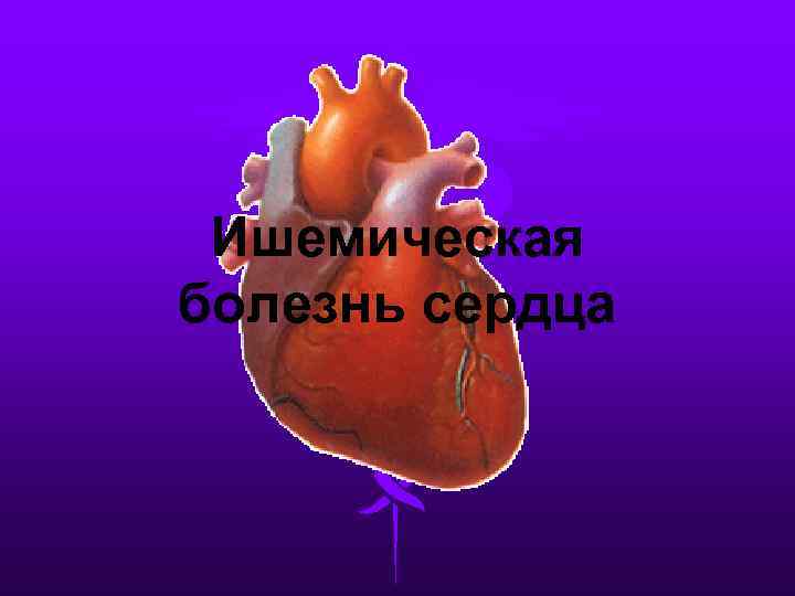 Ишемическая болезнь сердца 