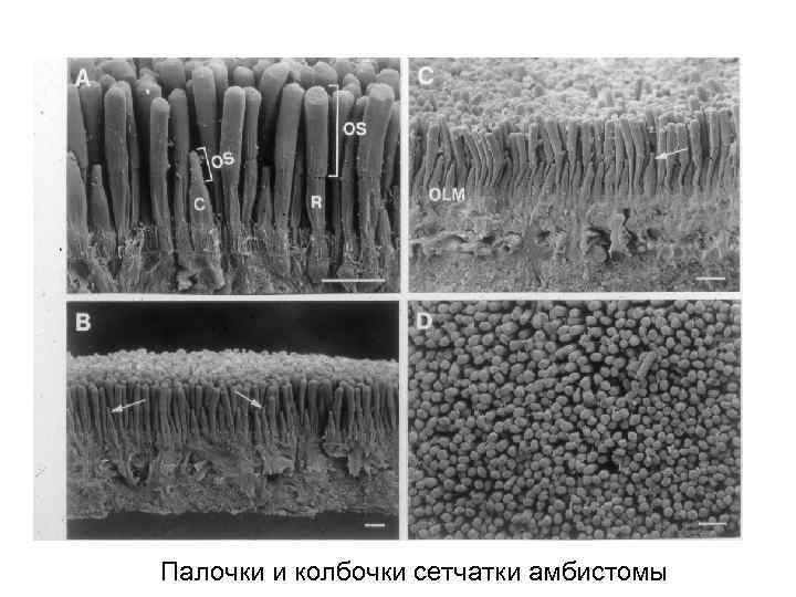 На рисунке пигментного эпителия сетчатки изображены гранулы меланина расположенные