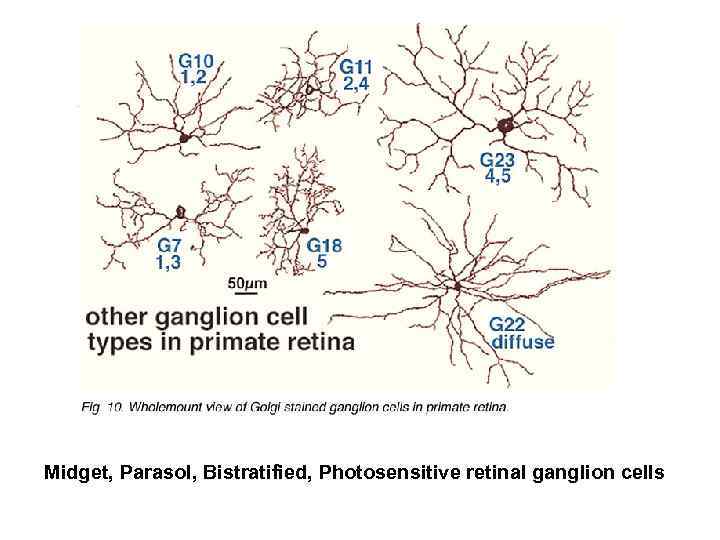 Midget, Parasol, Bistratified, Photosensitive retinal ganglion cells 