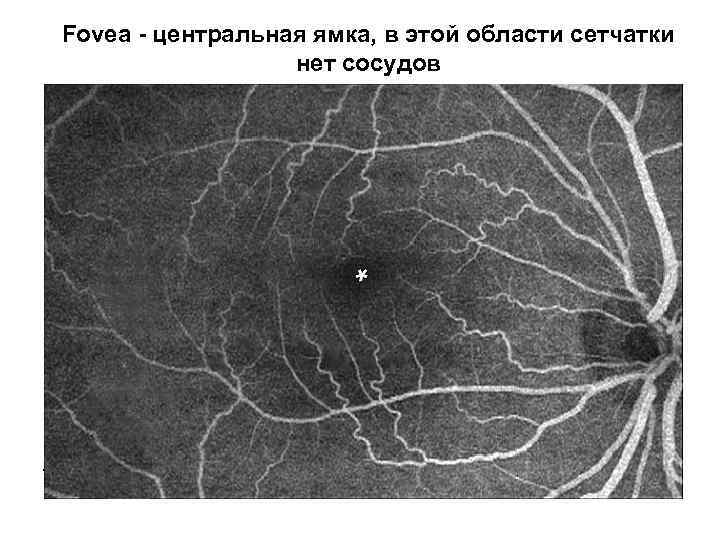 Fovea - центральная ямка, в этой области сетчатки нет сосудов 