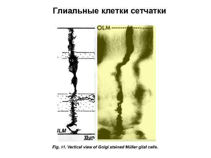 Глиальные клетки сетчатки 