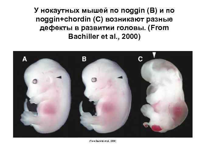 У нокаутных мышей по noggin (В) и по noggin+chordin (С) возникают разные дефекты в