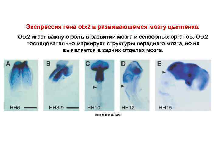 Экспрессия гена otx 2 в развивающемся мозгу цыпленка. Otx 2 игает важную роль в