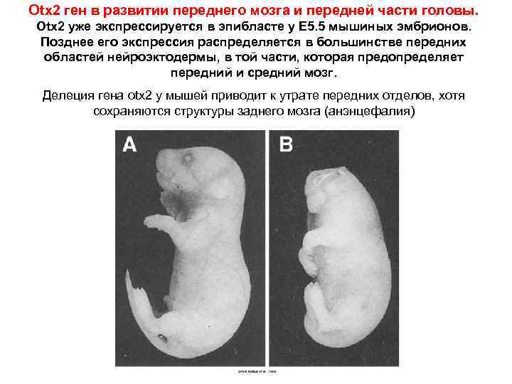 Otx 2 ген в развитии переднего мозга и передней части головы. Otx 2 уже