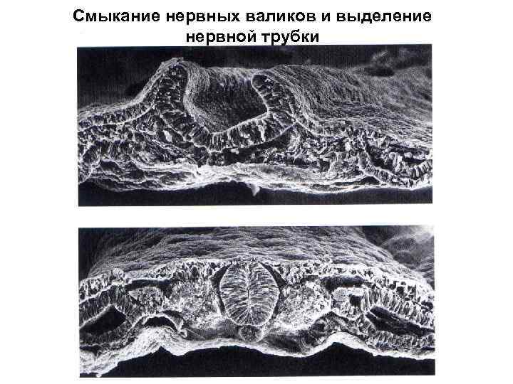 Смыкание нервных валиков и выделение нервной трубки 