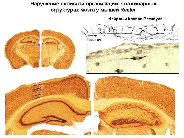 Нарушение слоистой организации в ламинарных структурах мозга у мышей Reeler Нейроны Кахала-Ретциуса 