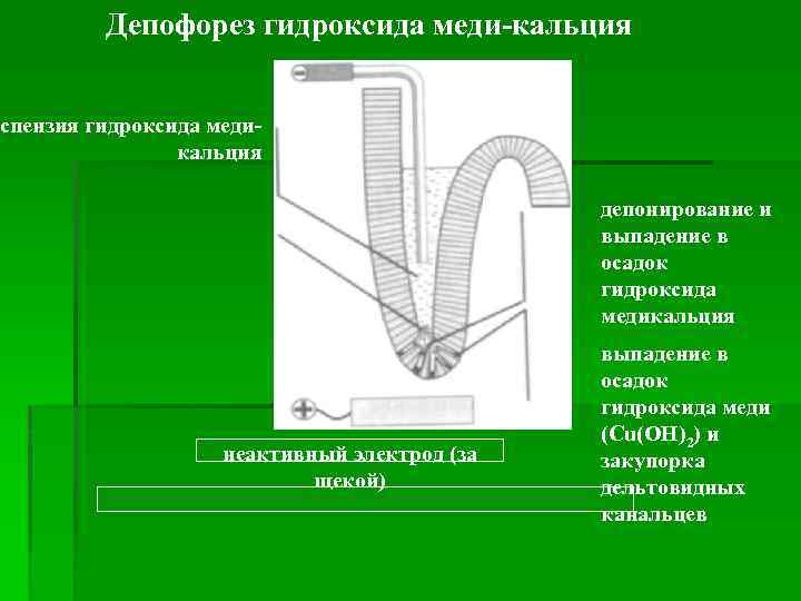    Депофорез гидроксида меди-кальция  спензия гидроксида меди-   кальция 